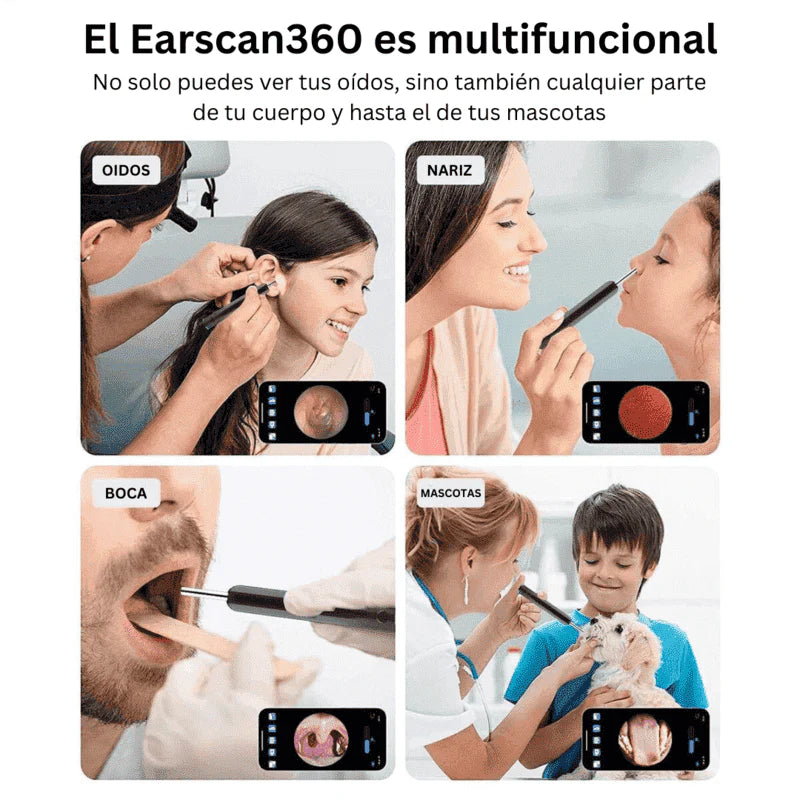 EASYSCAN™ | Limpiador De Oido Con Camara